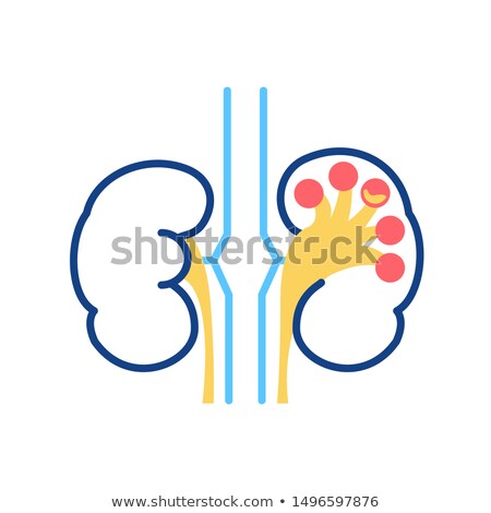 Zdjęcia stock: Chronic Pyelonephritis Diagnosis Medical Concept