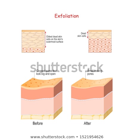 Foto stock: Exfoliation Cosmetology