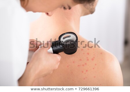 Stock fotó: Doctor Checking Acne Of Male Patient