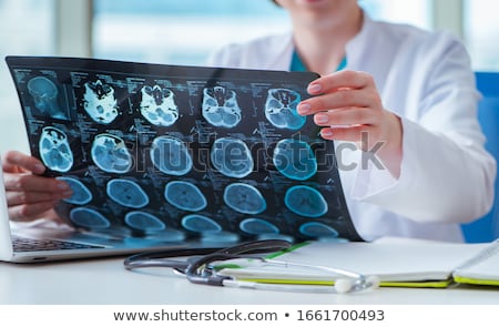 Foto stock: Doctors Looking At An Mri Scan At Computer