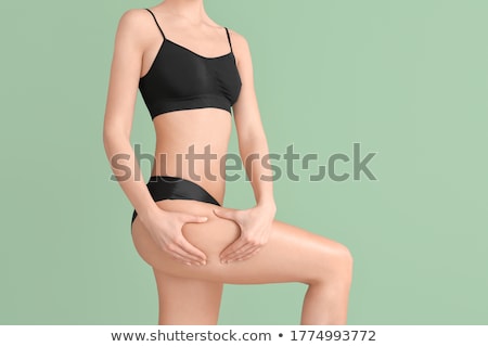 Stock fotó: Cellulite Medical Concept On Green Background