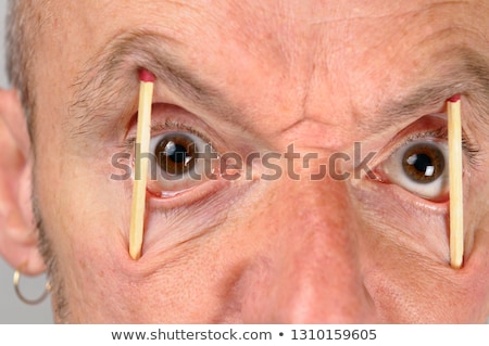 Foto stock: Bleary Eyed Tired Man Bloodshot Eyes