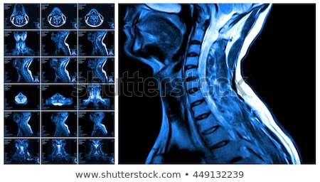 Foto d'archivio: Magnetic Resonance Imaging Of The Cervical Spine