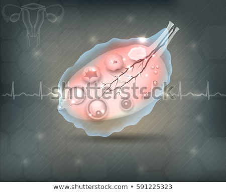 Zdjęcia stock: Female Ovary Disorder Concept On An Abstract Grey Mesh Backgroun