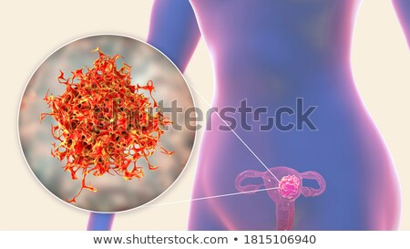 Zdjęcia stock: Uterine Cancer Medicine 3d Illustration