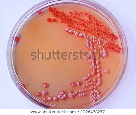 Foto stock: Overhead View Of Laboratory Petri Dish Bacterial Cultures