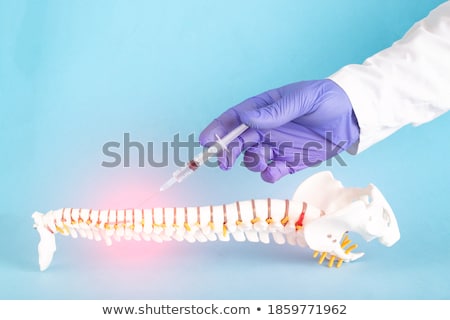 Zdjęcia stock: Disc Protrusion Medical Concept On Red Background