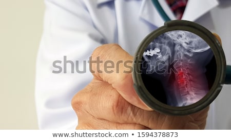 Stock photo: Diagnosis - Radiculopathy Medical Concept