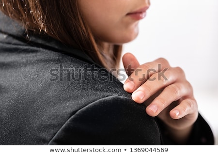 Foto stock: Dandruff On Businesswomans Shoulder