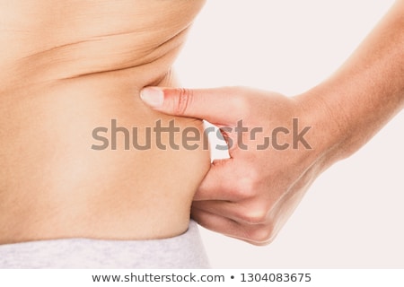 Stock foto: Liposuction Cellulite And Fat Treatment