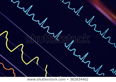 Stockfoto: Cardiogram Macro Of Ecg Graph