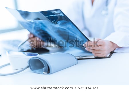 Foto stock: Doctor Woman Looking At Patient X Rays