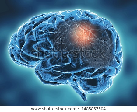 Stockfoto: Neurological Disorder Concept