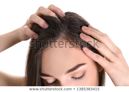 Foto stock: Dandruff In Womans Hair