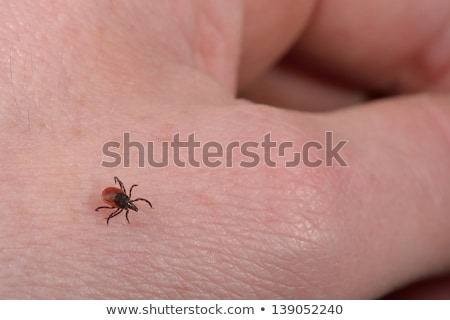 Imagine de stoc: Tick Bite Human Hand