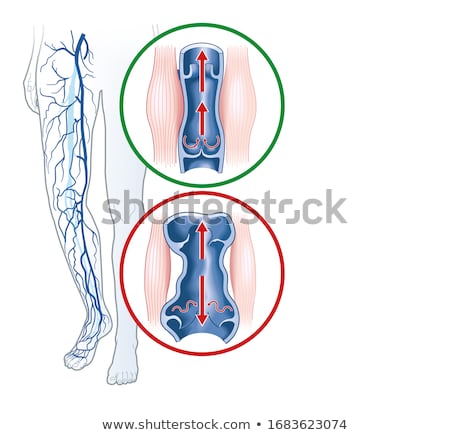 Foto stock: Normal Vein And Varicose Vein