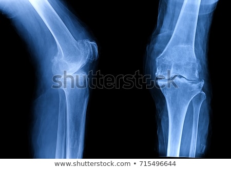 Zdjęcia stock: Doctor Examining Knee X Ray