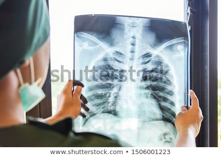 Foto stock: Lung Disease