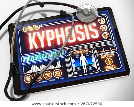 Foto d'archivio: Kyphosis On The Display Of Medical Tablet