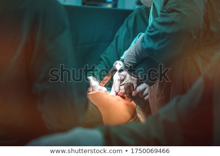 Foto stock: Coxarthrosis Diagnosis Medical Concept