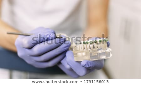 Foto stock: Dentist Shows Model Jaw