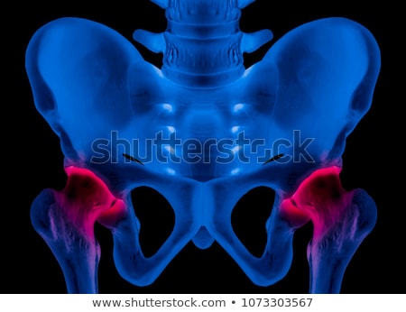 ストックフォト: 3d Painful Hip In Black Background