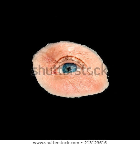 Imagine de stoc: Artificial Eye And Skin For Destroyed Eye Sockets