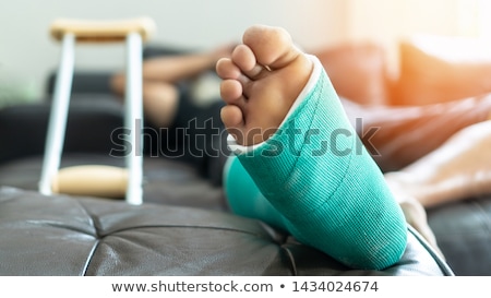 Foto stock: Broken Bone