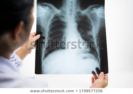 Stockfoto: Chest X Ray And Mri Scans