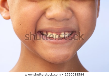 Stock foto: Dentistry And Tooth Growth
