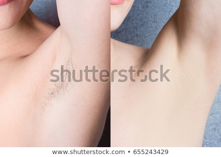 ストックフォト: Before And After Concept Of Underarm Hair Removal