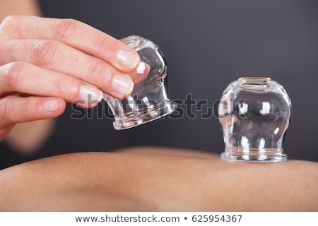Zdjęcia stock: Therapist Giving Cupping Therapy To Man