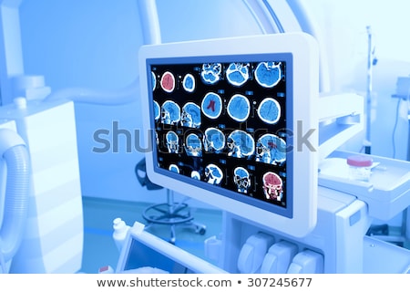 Foto d'archivio: Doctor Analyzing Human Skull X Ray Screening Image