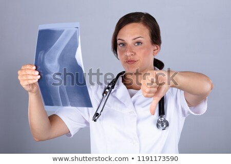 Stok fotoğraf: Doctor With Knee X Ray Gesturing Thumbs Down