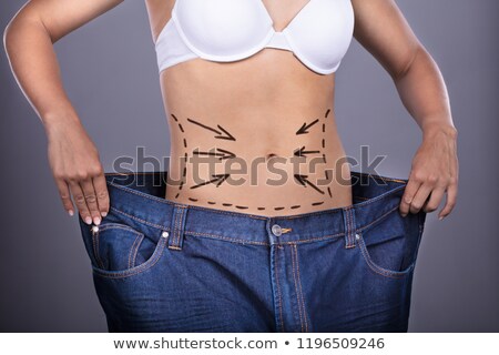 Zdjęcia stock: Woman With Correction Lines On Belly Showing Weightloss