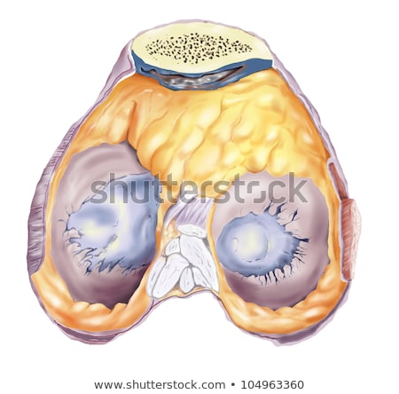 Arthritis Arthrosis Pathology Of The Knee Imagine de stoc © Alexonline