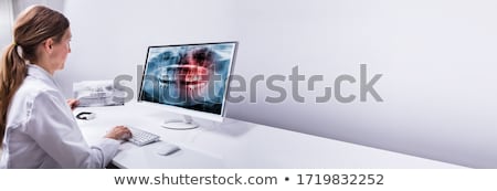 Foto d'archivio: Dentist Looking At Teeth X Ray On Computer