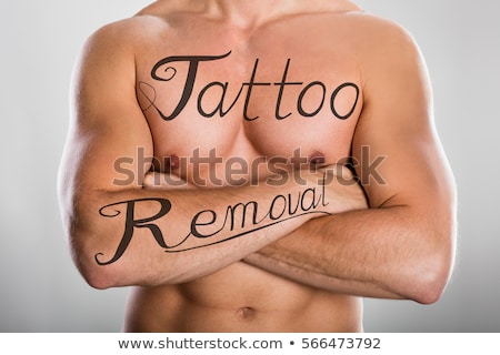 Foto d'archivio: Tattoo Removal Text On Mans Body