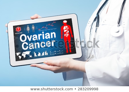 Foto stock: Ovarian Cancer On The Display Of Medical Tablet