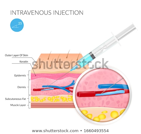 Stock fotó: Intravenous Injection