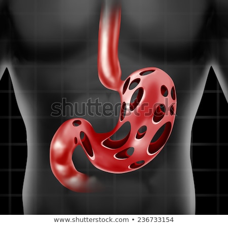 Stok fotoğraf: Diagnosis - Peptic Ulcer Medical Concept