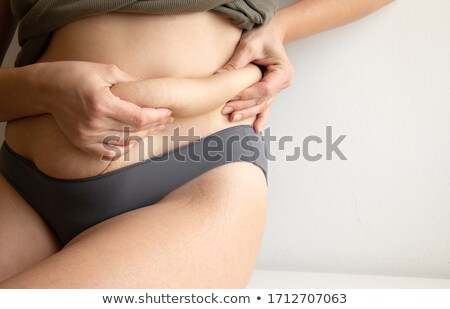 Stockfoto: Woman Pinches Her Fat