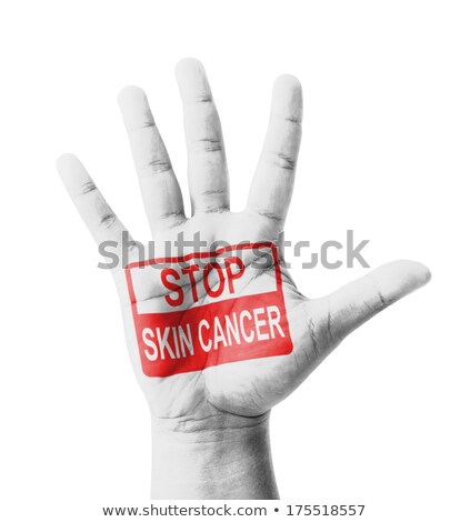 Foto stock: Stop Skin Cancer Concept On Open Hand