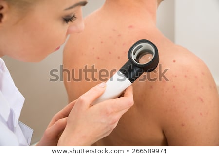 Stok fotoğraf: Doctor Examining Pigmented Skin On Mans Back