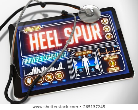 Foto stock: Heel Spur On The Display Of Medical Tablet