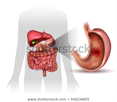 Foto stock: Stomach Ulcer Interanal Organs Anatomy Colorful Drawing