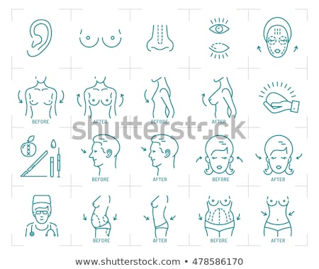 Сток-фото: Liposuction Concept Vector Illustration