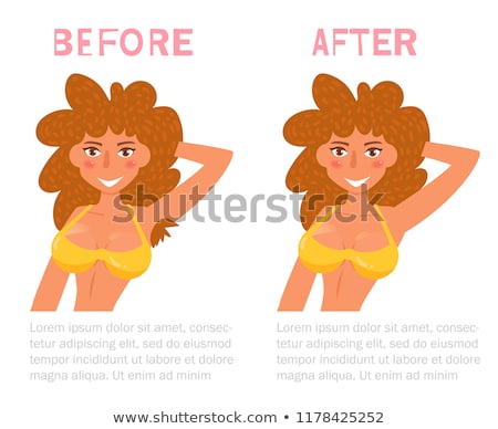 Stockfoto: Body Care And Clean Skin Depilation Concept Waxing For Beautiful Woman Brazilian Laser Hair Remov