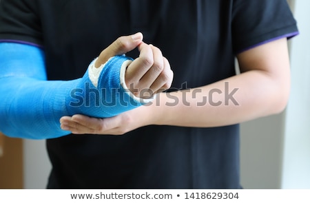 Foto stock: Broken Wrist In Gypsum