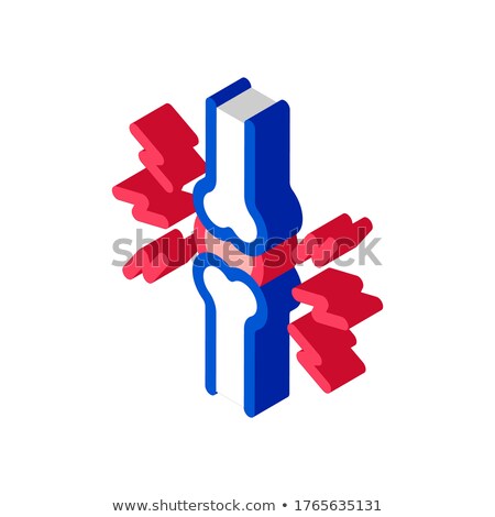 Foto stock: Joint Pain Isometric Icon Vector Illustration